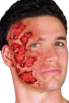 Latex Prosthesis Burning Effect on the Face